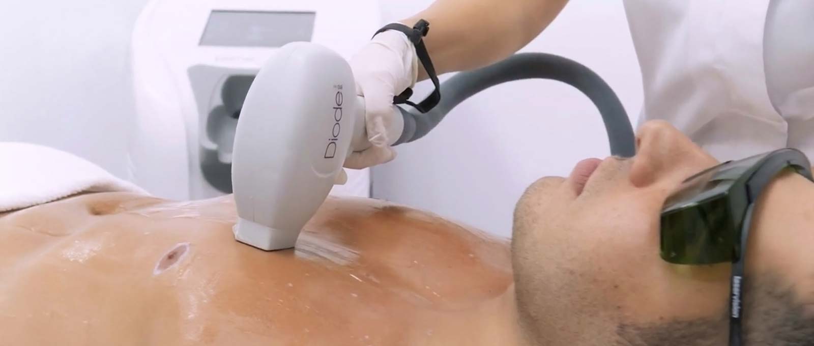 Laser-Treatment
